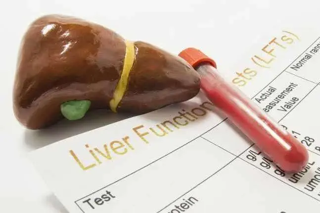 Does Alcohol Cause Fatty Liver Disease? 1 Alcoholism recovery center